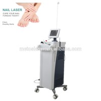 Nd YAG Laser Fungal Nail Laser Treatment / Onychomycosis With Intelligent Alert System